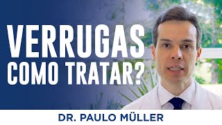 Verrugas de Pele O Que São e Como Tratar – Dr Paulo Müller Dermatologista [upl. by Otto]