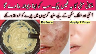 Multani mitti face pack for acne and glowing skinHow to remove acne from face Multani mitti pack [upl. by Andrel]