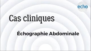 Échographie abdominale [upl. by Nolyat]