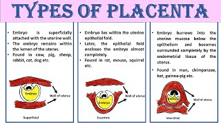 Types of placenta [upl. by Seema]