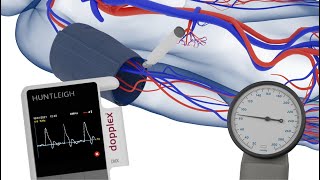 How to Measure the Brachial Pressures when Performing an ABPI [upl. by Kleper512]