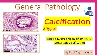 Pathological Calcification [upl. by Nnyladnarb]