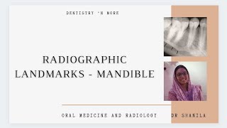 Mastering Anatomical Landmarks of Maxilla in Depth All You Need To Know [upl. by Pierro945]