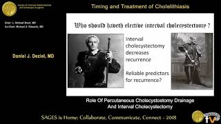 Percutaneous cholecystostomy amp interval cholecystectomy [upl. by Drarej329]