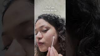 Overnight Acne Spot Corrector  How to Use [upl. by Monjo68]