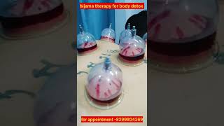 Hijama Therapy Detoxify Your Body Naturally viralvideotrendingshortsshortgymbodybuildingfyp [upl. by Eimyaj]