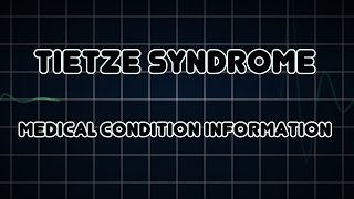 Tietze syndrome Medical Condition [upl. by Atirres]