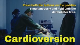 cardioversion How to give Shock with defibrillator and why [upl. by Lough]