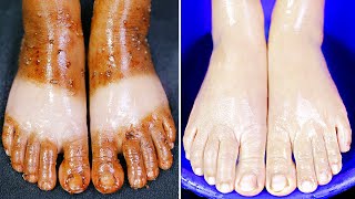 1 Day Challenge  Feet Whitening at Home 😍 How to Get Whiten Feet Instantly [upl. by Gerstner]