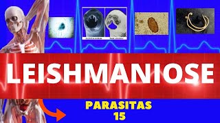 LEISHMANIOSE VISCERAL E LEISHMANIOSE TEGUMENTAR LEISHMANIA SSP  PARASITOLOGIA INFECTOLOGIA [upl. by Strauss504]