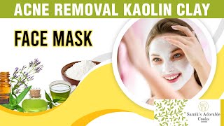 Kaolin Clay Face Mask Recipe for Sensitive skin Clogged Pores Blackheads and Acne [upl. by Poirer]