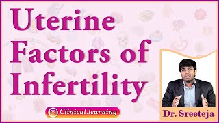 42 Uterine Factors of Infertility [upl. by Eben38]