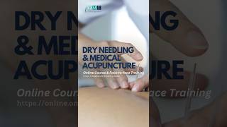 Get your CERTIFICATION in Dry Needling now osteopathy acupuncture manualtherapy [upl. by Nitsraek779]