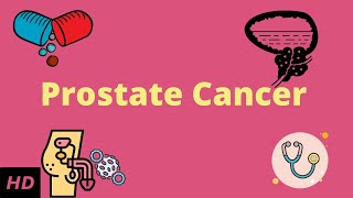 Prostrate Cancer Causes Signs and Symptoms DIagnosis and Treatment [upl. by Nalyd]