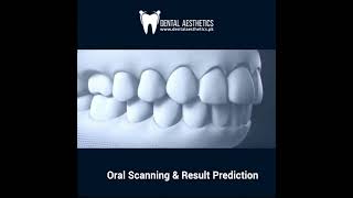 Invisalign Clear Aligners Before and After 3D Animation  Teeth Straightening [upl. by Chien]