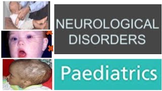 2 Neurological Disorders Paediatrics  Pyogenic Meningitis  Def PathogensisClinical Findings [upl. by Aspasia43]