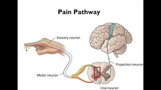 Electrotherapy Lecture 2 How do we perceive acute and chronic pain  How can we treat both types [upl. by Melas]