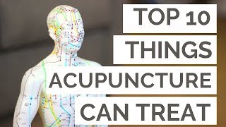 The Top 10 Conditions Acupuncture Can Help [upl. by Rein]