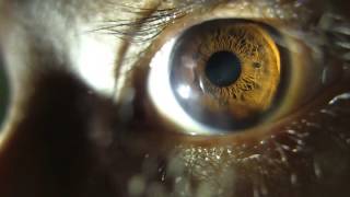 Pupil Dilating eye changing apeture HD [upl. by Azal]