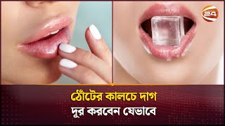 ঠোঁটের কালচে দাগ দূর করবেন যেভাবে  How to get rid of dark spots on lips  Channel 24 [upl. by Nevetse]