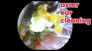 wax in your ear  Ear health  ear piercing cleaning how to unclog your ear  Removing cerumen [upl. by Teresita]