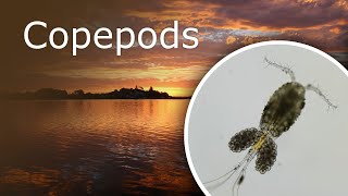 Copepods Cyclops Under a Microscope Description Habitat and Anatomy [upl. by Jamesy698]