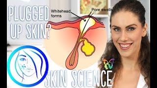 WHY DOES MY SKIN GET CLOGGED AND HOW TO GET RID OF CLOGGED PORES  Skin Science Episode 6 [upl. by Margetts768]