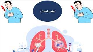 Chest Pain  Cause of Chest Pain  Differential Diagnosis of Chest Pain  Approach to Chest Pain [upl. by Enitsirc]