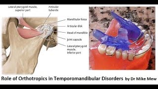 Orthotropics Treatment of Temporomandibular Joint Disorders by Dr Mike Mew [upl. by Kellda619]