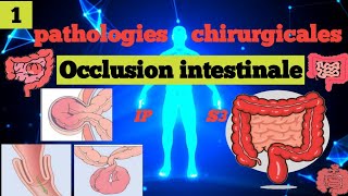 cours S3  Pathologies Chirurgicales et SI  Occlusion Intestinale Aiguë 1 OIA🩺🎯📚شرح سهل و مبسط 📚 [upl. by Wald620]