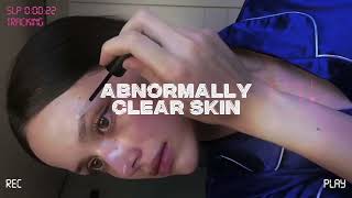 ABNORMALLY clear skin  2X MAX  Vetala reupload [upl. by Ruttger]