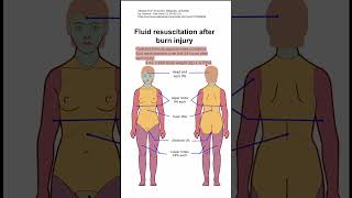 Fluid resuscitation after burn injury [upl. by Nibbor]