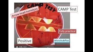 CAMP test CAMP Factor  CAMP Reaction  Microbiology Streptococcus agalactiae [upl. by Pelage]