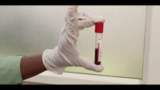 Mastering Blood Sample Collection StepbyStep Guide and Pro Tips for Phlebotomy or Venepuncture [upl. by Oiromed910]