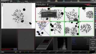 DCScore  Automated Scoring of Dicentric Chromosomes [upl. by Eula]