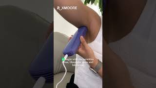 I Tried This Hair Removal Gadget and You Wont BELIEVE What Happened rxmoore iplhairremoval skin [upl. by Constantia106]