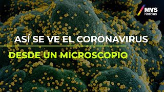 Así se ve el coronavirus desde un microscopio [upl. by Ladnyc]