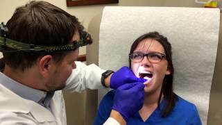 Canker Sore Treatment by Dermatologist Dr David Myers [upl. by Yelkcub]