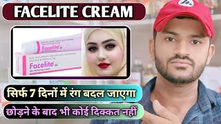 Facelite cream uses dose benefits and Side effects full review in hindi [upl. by Arhat]