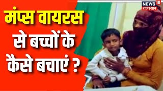 Mumps Virus कितना खतरनाक जानिए इससे बचने का क्या है कारण  Mumps Virus Symptoms । What Is Mumps [upl. by Horlacher671]