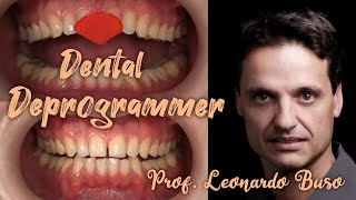 Determination of central occlusion centric relation  Deppogrammer Prof Leonardo Buso [upl. by Bouchier212]