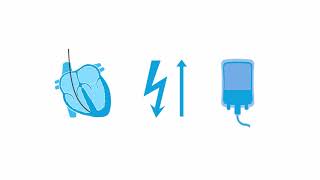 Transvenous pacing troubleshooting [upl. by Sharleen]