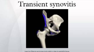 Transient synovitis [upl. by Goulder736]