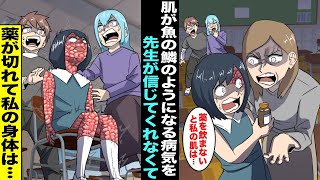 【漫画】肌が魚の鱗のようになる病気になってしまった私は薬で進行を遅らせていたが新任の先生は私の病気を信じてくれず…薬が切れて私の身体はおかしくなってしまい・・・ [upl. by Airamat]