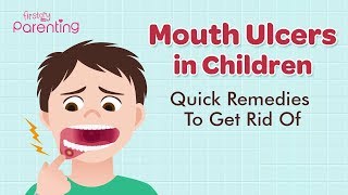 Mouth Ulcers Canker Sores in Children  Causes Symptoms amp Treatment [upl. by Arsuy]