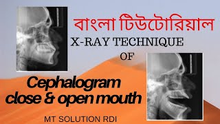 Cephalogram Open and close Ep05 বাংলা টিউটোরিয়াল Dental x ray [upl. by Eerolam]