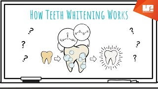 How Teeth Whitening Works [upl. by Ozner]