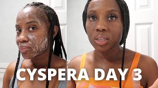 Cyspera Cysteamine Day 3  My Daily Melasma  Hyperpigmentation Skin Care Routine [upl. by Mcallister336]