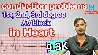 av block ecg  1st degree av block  2nd degree AV block  complete heart block  CHB ecg [upl. by Ayekahs]