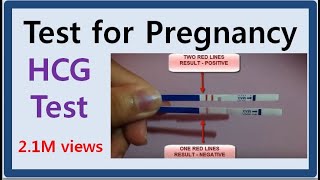 TEST FOR PREGNANCY [upl. by Nevin]